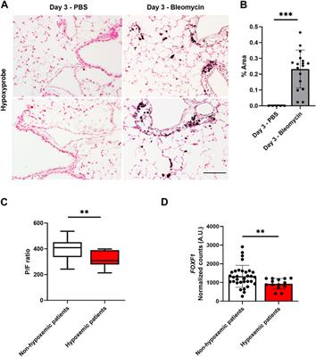 Hypoxia represses FOXF1 in lung endothelial cells through HIF-1α